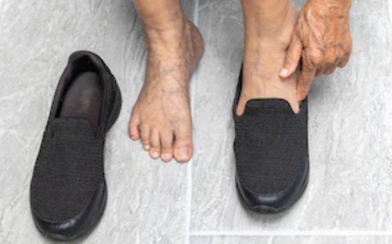 enchufe Asociación Colector Zapatos para pie diabético: Estas son las mejores marcas, según Profeco -  El Sol de Puebla | Noticias Locales, Policiacas, sobre México, Puebla y el  Mundo